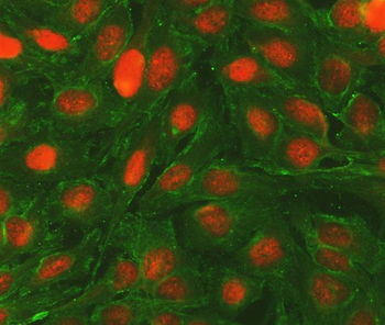 Anti-Bcl-2/BCL2 Antibody