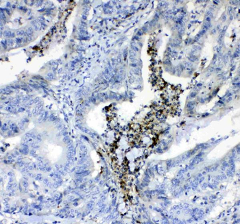Anti-Prothrombin/F2 Antibody