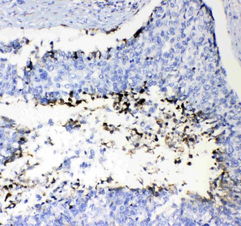 Anti-Prothrombin/F2 Antibody