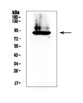 Anti-Prothrombin/F2 Antibody