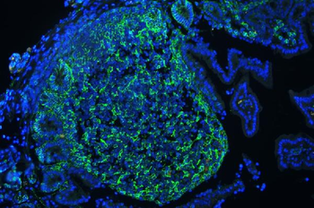 Anti-CD44 Antibody