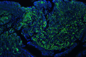 Anti-CD44 Antibody