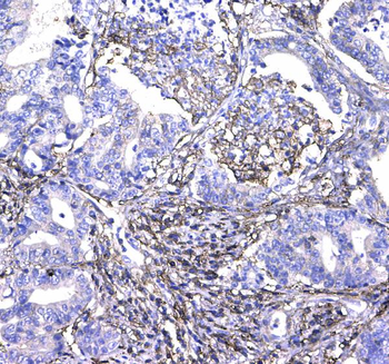 Anti-CD44 Antibody