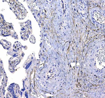 Anti-CD44 Antibody