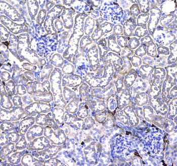 Anti-CD44 Antibody