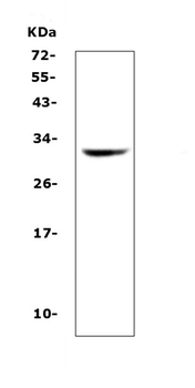 Anti-HLA-DQB1 Antibody