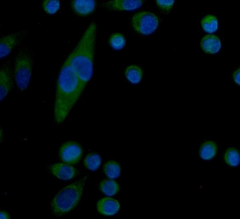 Anti-Serum Amyloid P/APCS Antibody