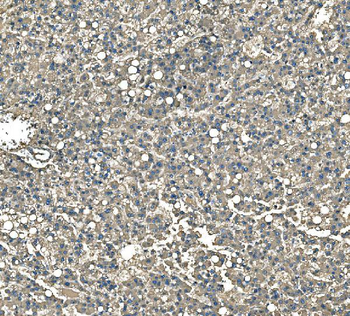 Anti-Serum Amyloid P/APCS Antibody