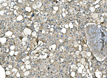 Anti-Serum Amyloid P/APCS Antibody