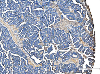 Anti-Serum Amyloid P/APCS Antibody