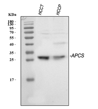 Anti-Serum Amyloid P/APCS Antibody
