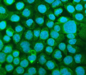 Anti-ICAM1 Antibody