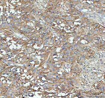 Anti-ICAM1 Antibody