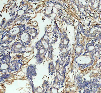 Anti-ICAM1 Antibody