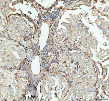 Anti-ICAM1 Antibody