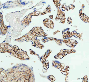 Anti-ICAM1 Antibody