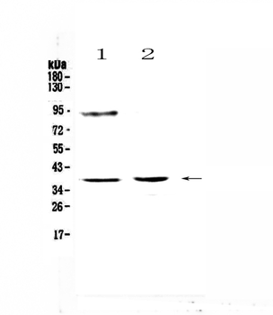 TATA binding protein TBP Rabbit Polyclonal Antibody