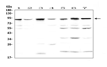 BAP1 Rabbit Polyclonal Antibody