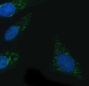 NADPH oxidase 4/NOX4 Rabbit Polyclonal Antibody