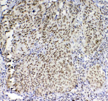 Anti-PRDM1/Blimp1 Antibody