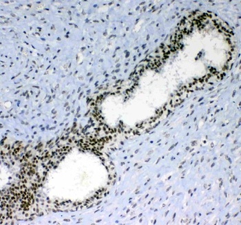 PRDM1/Blimp1 Antibody
