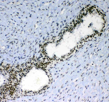 Anti-PRDM1/Blimp1 Antibody