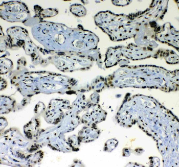 Anti-PRDM1/Blimp1 Antibody