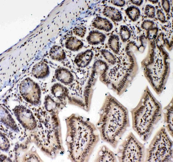 Anti-PRDM1/Blimp1 Antibody