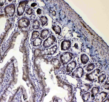 Anti-PRDM1/Blimp1 Antibody
