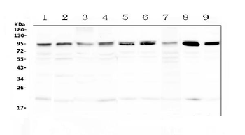 Anti-PRDM1/Blimp1 Antibody