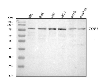 Anti-Topoisomerase I/TOP1 Antibody