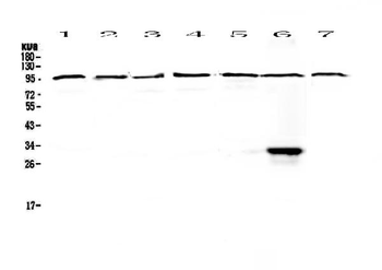 DGCR8 Antibody