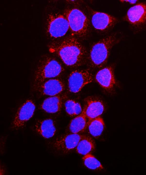 Anti-VEGF Receptor 1/FLT1 Antibody