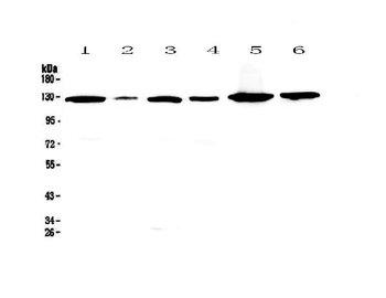 Anti-VEGF Receptor 1/FLT1 Antibody