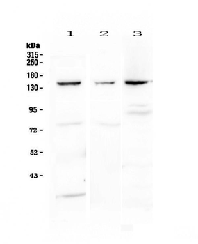 VEGF Receptor 1/FLT1 Antibody