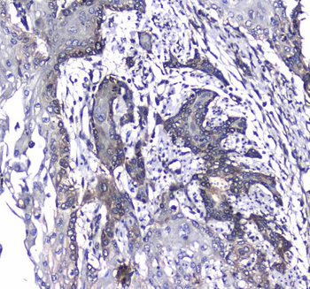 Anti-L1CAM Antibody