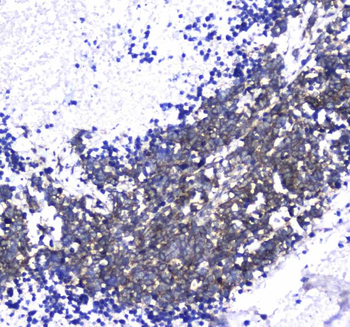Anti-L1CAM Antibody