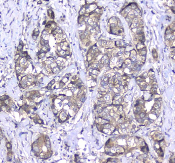 Anti-L1CAM Antibody