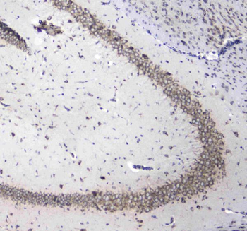 Anti-L1CAM Antibody