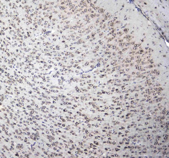 Anti-L1CAM Antibody