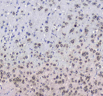 Anti-L1CAM Antibody