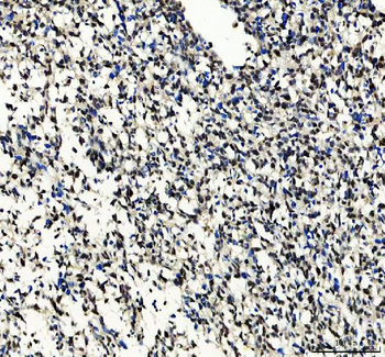 Anti-SOX10 Antibody