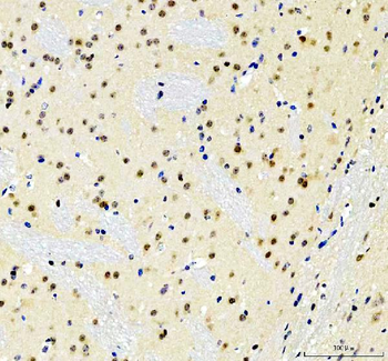Anti-SOX10 Antibody