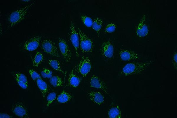 Anti-CLPX Antibody