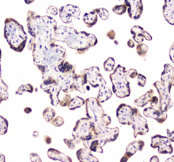 Anti-CLPX Antibody