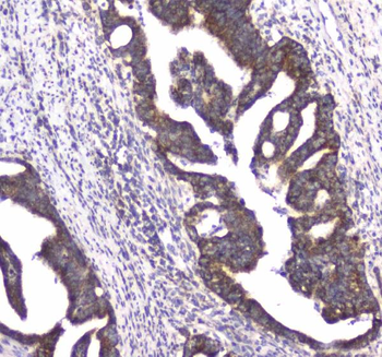 Anti-CLPX Antibody