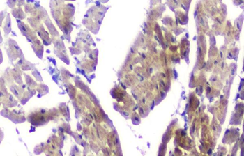 Anti-CLPX Antibody