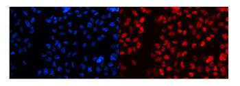 Anti-splicing factor 1/SF1 Antibody