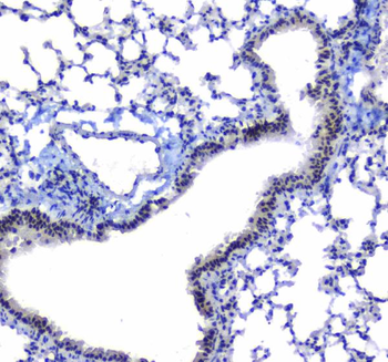 Anti-splicing factor 1/SF1 Antibody