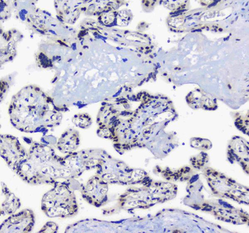 Anti-splicing factor 1/SF1 Antibody